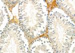 MRPS15 Antibody in Immunohistochemistry (Paraffin) (IHC (P))