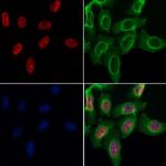 MYF5 Antibody in Immunocytochemistry (ICC/IF)
