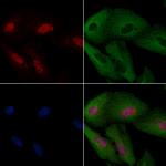 MYF5 Antibody in Immunocytochemistry (ICC/IF)