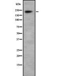 SCN1A Antibody in Western Blot (WB)