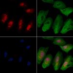 NCKIPSD Antibody in Immunocytochemistry (ICC/IF)