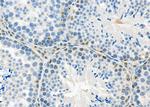 NCKIPSD Antibody in Immunohistochemistry (Paraffin) (IHC (P))