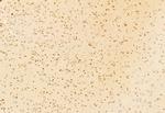 NCOA4 Antibody in Immunohistochemistry (Paraffin) (IHC (P))