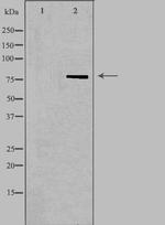 NDUFS1 Antibody in Western Blot (WB)