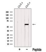 WHSC2 Antibody in Western Blot (WB)