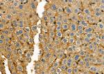 NKTR Antibody in Immunohistochemistry (Paraffin) (IHC (P))