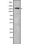 NKTR Antibody in Western Blot (WB)