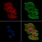 NLRP3 Antibody in Immunocytochemistry (ICC/IF)