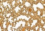 NSUN2 Antibody in Immunohistochemistry (Paraffin) (IHC (P))