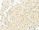 OSBP Antibody in Immunohistochemistry (Paraffin) (IHC (P))