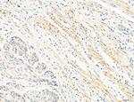 OSBP Antibody in Immunohistochemistry (Paraffin) (IHC (P))