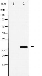 p27 Kip1 Antibody in Western Blot (WB)