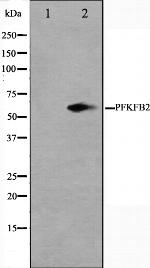 PFKFB2 Antibody in Western Blot (WB)