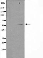 PFKFB2 Antibody in Western Blot (WB)