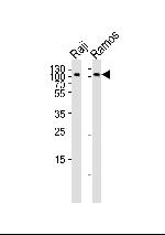 CD19 Antibody in Western Blot (WB)