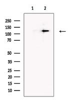 PTCH2 Antibody in Western Blot (WB)