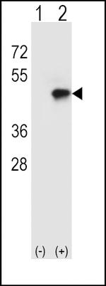 CD4 Antibody in Western Blot (WB)