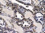 RAB17 Antibody in Immunohistochemistry (Paraffin) (IHC (P))