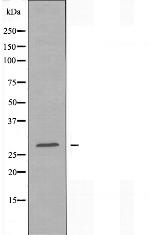 RAB20 Antibody in Western Blot (WB)