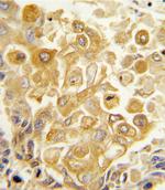 TLR2 Antibody in Immunohistochemistry (Paraffin) (IHC (P))