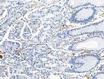 TAGLN Antibody in Immunohistochemistry (Paraffin) (IHC (P))