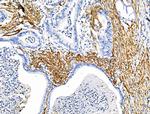 TAGLN Antibody in Immunohistochemistry (Paraffin) (IHC (P))