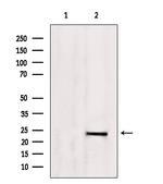 TAGLN Antibody in Western Blot (WB)