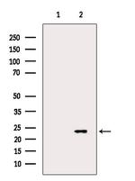 TAGLN Antibody in Western Blot (WB)