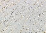 SP6 Antibody in Immunohistochemistry (Paraffin) (IHC (P))