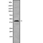 SP6 Antibody in Western Blot (WB)