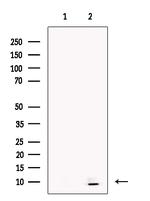 STATH Antibody in Western Blot (WB)