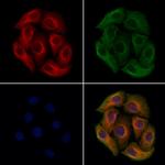 PLS3 Antibody in Immunocytochemistry (ICC/IF)