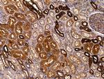 PLS3 Antibody in Immunohistochemistry (Paraffin) (IHC (P))