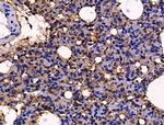 PLS3 Antibody in Immunohistochemistry (Paraffin) (IHC (P))