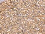 PLS3 Antibody in Immunohistochemistry (Paraffin) (IHC (P))