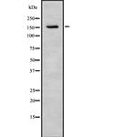 Tensin 3 Antibody in Western Blot (WB)