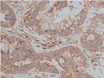 TSC1 Antibody in Immunohistochemistry (Paraffin) (IHC (P))