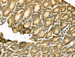 TSC1 Antibody in Immunohistochemistry (Paraffin) (IHC (P))