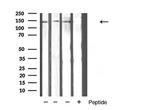 TSC1 Antibody in Western Blot (WB)