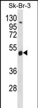 WDR34 Antibody in Western Blot (WB)