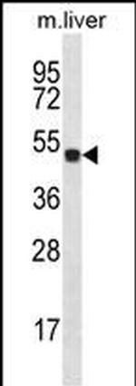 HOXD10 Antibody in Western Blot (WB)