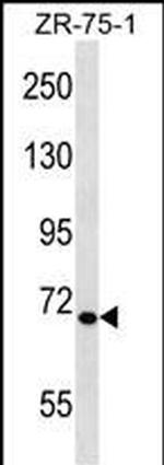 TEC Antibody in Western Blot (WB)