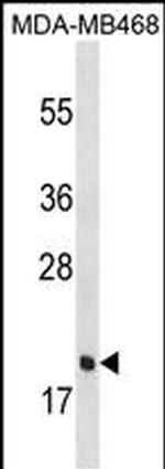 PGLYRP1 Antibody in Western Blot (WB)