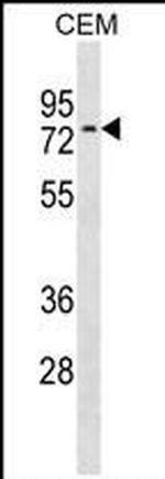 NRXN3 Antibody in Western Blot (WB)