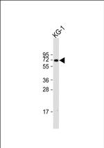 ZNF93 Antibody in Western Blot (WB)