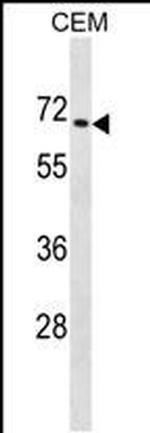 ZNF93 Antibody in Western Blot (WB)