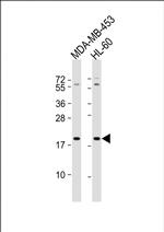 ZNF740 Antibody in Western Blot (WB)