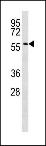 CCDC155 Antibody in Western Blot (WB)