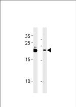 C13orf30 Antibody in Western Blot (WB)