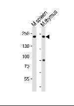 ZCCHC11 Antibody in Western Blot (WB)